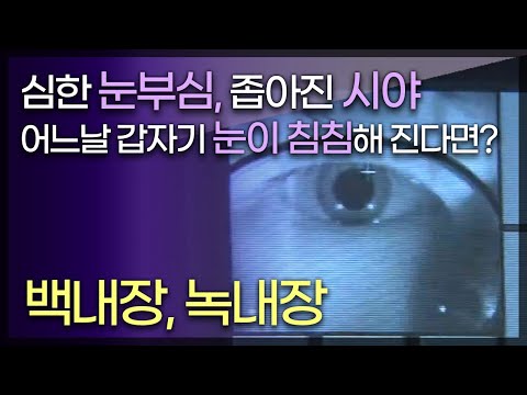 대표적인 노인성 안질환으로 알려진 백내장,녹내장. 젊은층 환자도 늘어남/신체중 가장 예민한 눈, 침침하고 눈부심이심하고 시야가좁아지면?/TV닥터인사이드 부산MBC 150517 방송