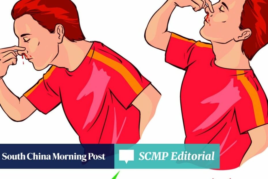 Got A Nosebleed? Stay Calm, Sit Down, And Don'T Tilt Your Head Back | South  China Morning Post