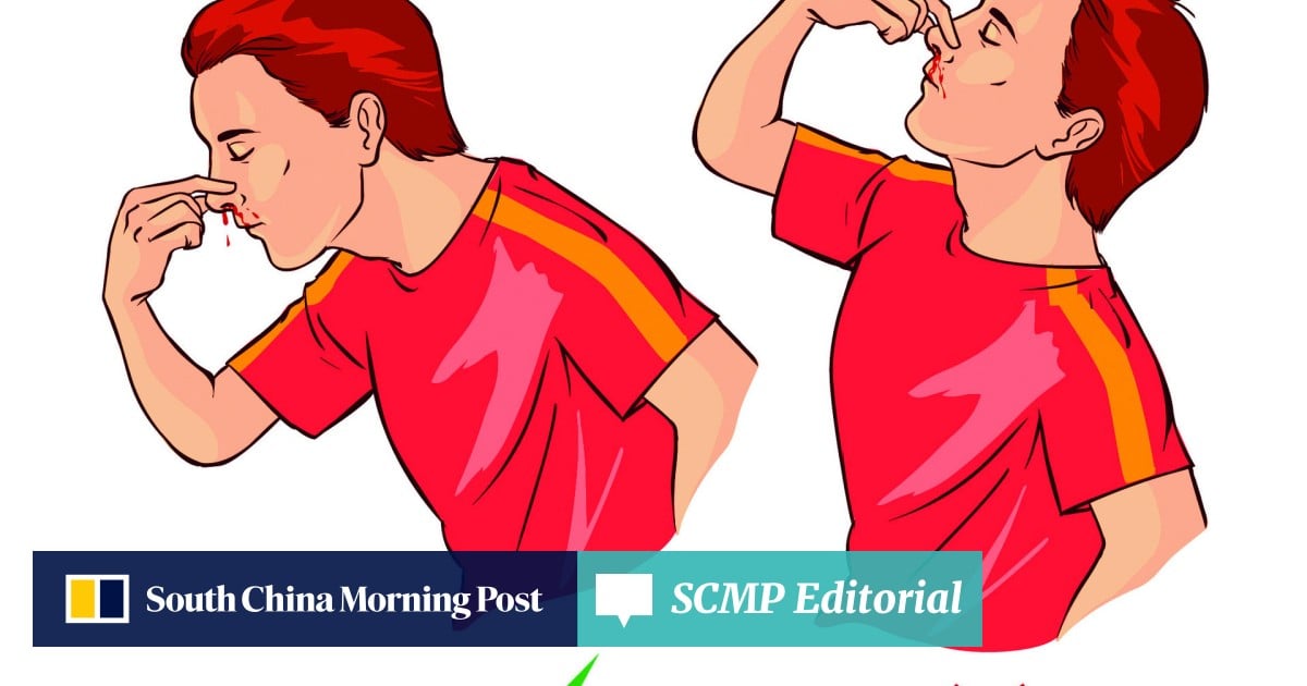 Got A Nosebleed? Stay Calm, Sit Down, And Don'T Tilt Your Head Back | South  China Morning Post