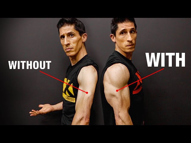 My Triceps Aren'T Growing” (Here'S Why!) - Youtube