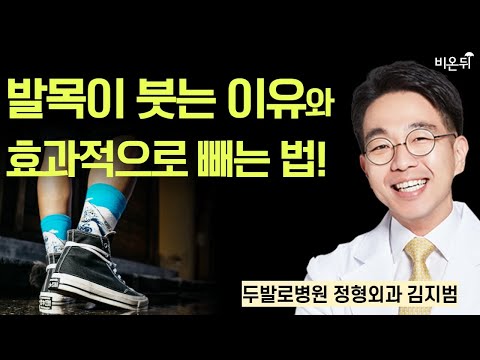 발목이 붓는 이유와 효과적으로 빼는 법! / 두발로병원 김지범