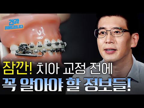 교정만으로 외모가 달라진다? 치아 교정 전 '이것'만은 반드시 확인하세요! [건강읽어드립니다] | 이상수 전문의