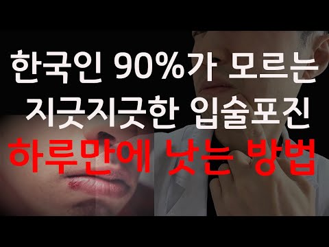 헤르페스 입술포진 하루만에 낫는 방법. 더이상 고통받을 필요가 없습니다!. 헤르페스