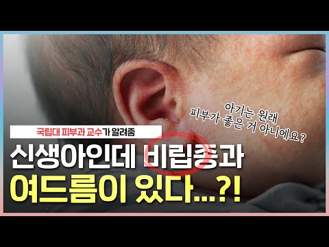 태어나자마자 여드름이 있다고?😱｜아기가 태어나면 엄마는 이런 것들을 주의 깊게 봐야 합니다! ｜신생아의 피부질환 - [언니네피부과]